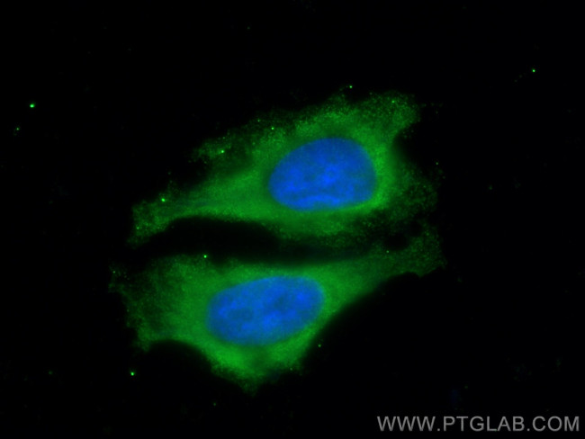 Cyclophilin A Antibody in Immunocytochemistry (ICC/IF)