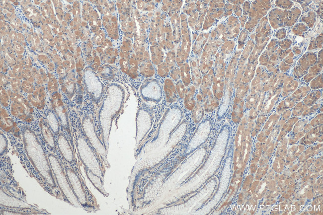 LPCAT3 Antibody in Immunohistochemistry (Paraffin) (IHC (P))