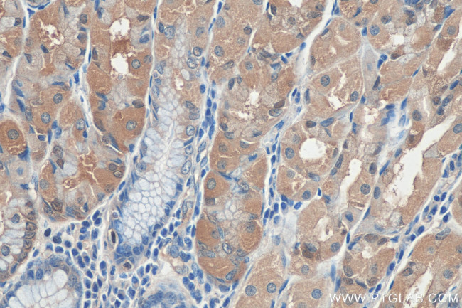 LPCAT3 Antibody in Immunohistochemistry (Paraffin) (IHC (P))