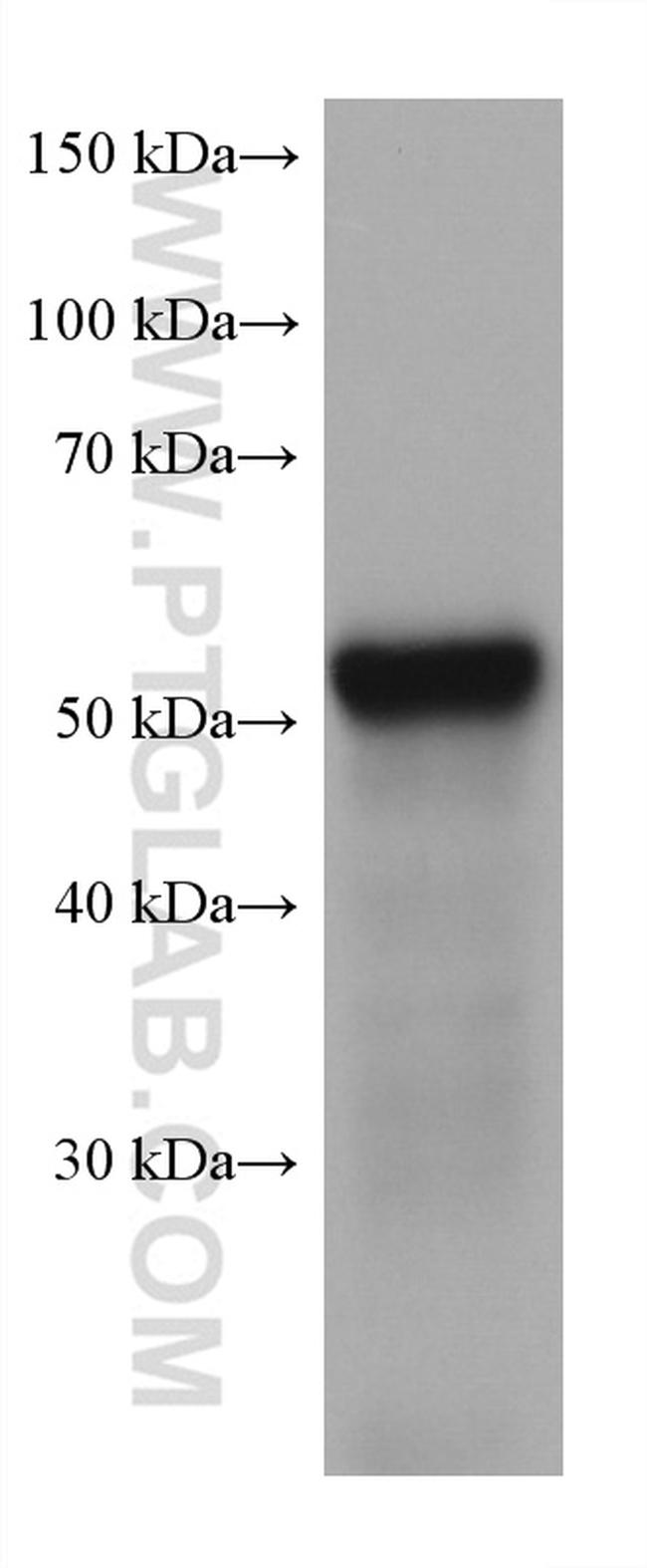 LPCAT3 Antibody in Western Blot (WB)