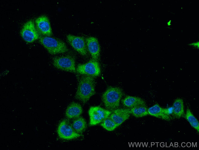 ADC Antibody in Immunocytochemistry (ICC/IF)