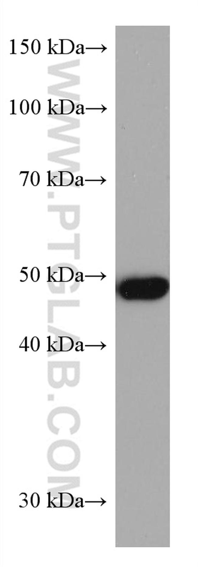 ADC Antibody in Western Blot (WB)