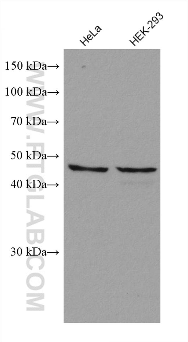 ADC Antibody in Western Blot (WB)