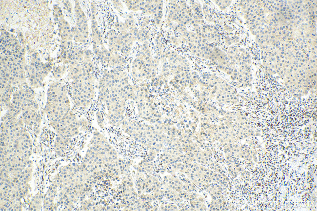 CDK7 Antibody in Immunohistochemistry (Paraffin) (IHC (P))