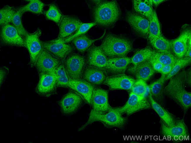 GARS Antibody in Immunocytochemistry (ICC/IF)