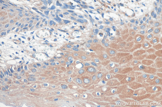 GARS Antibody in Immunohistochemistry (Paraffin) (IHC (P))