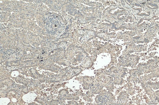 Stomatin Antibody in Immunohistochemistry (Paraffin) (IHC (P))