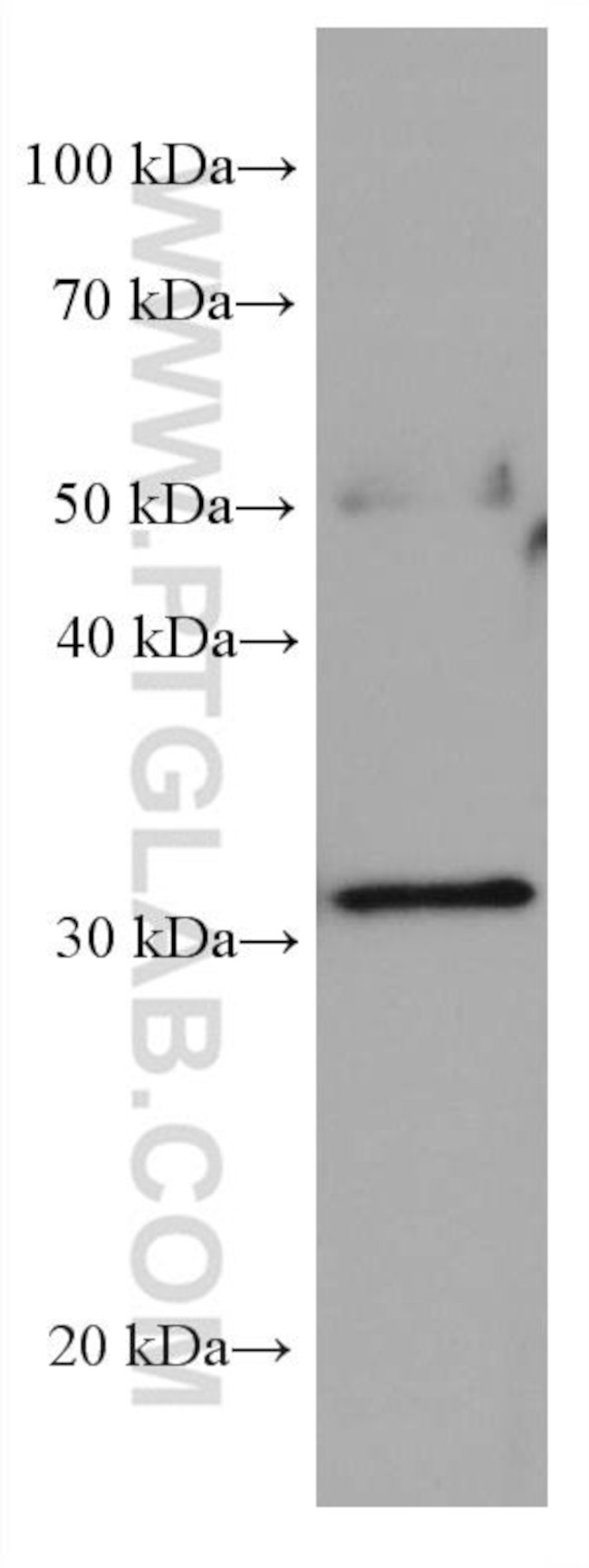 Stomatin Antibody in Western Blot (WB)