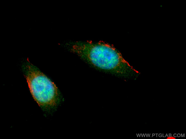 Importin Alpha 5 Antibody in Immunocytochemistry (ICC/IF)