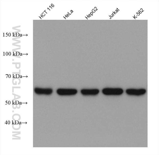 Importin Alpha 5 Antibody in Western Blot (WB)