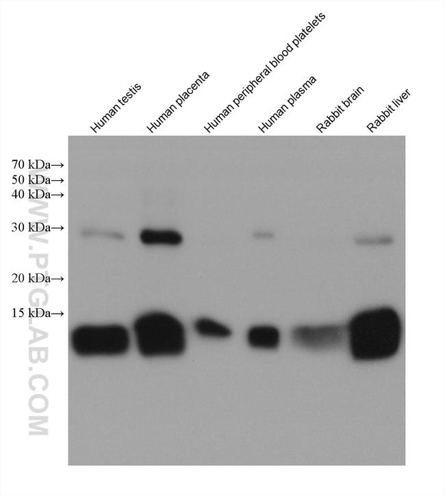 HBB Antibody in Western Blot (WB)