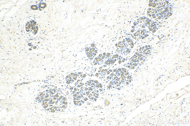 CIB1 Antibody in Immunohistochemistry (Paraffin) (IHC (P))