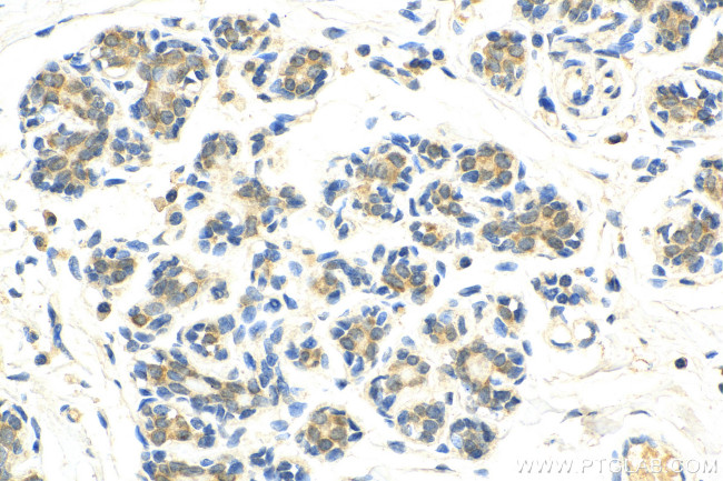 CIB1 Antibody in Immunohistochemistry (Paraffin) (IHC (P))