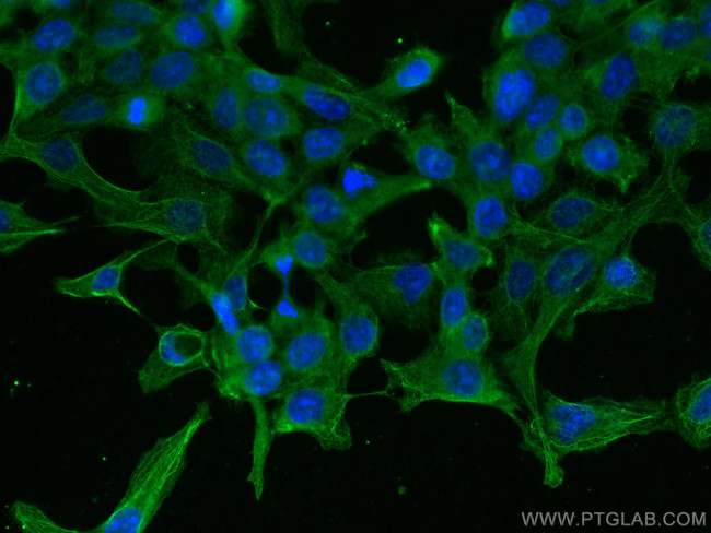 AlaRS Antibody in Immunocytochemistry (ICC/IF)