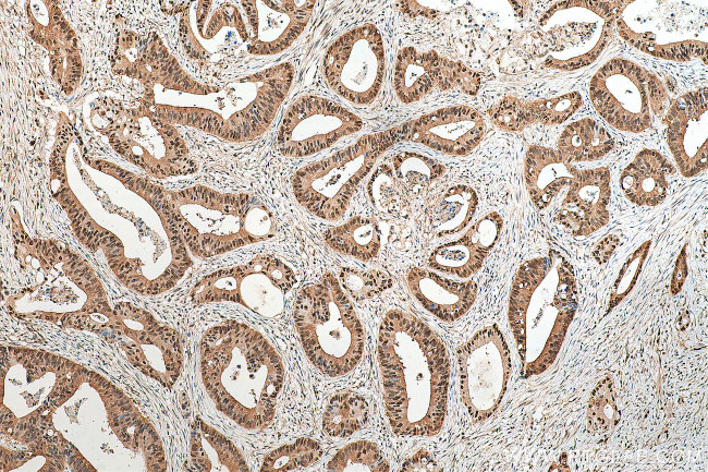 PSMA1 Antibody in Immunohistochemistry (Paraffin) (IHC (P))