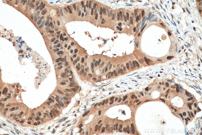 PSMA1 Antibody in Immunohistochemistry (Paraffin) (IHC (P))