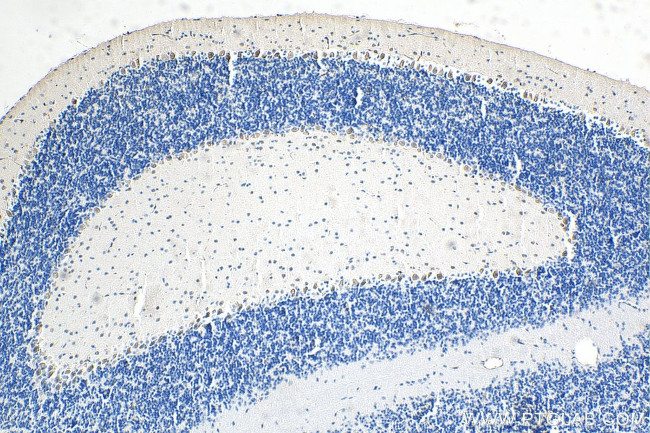 ROBO1 Antibody in Immunohistochemistry (Paraffin) (IHC (P))