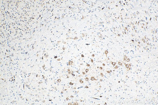 ROBO1 Antibody in Immunohistochemistry (Paraffin) (IHC (P))