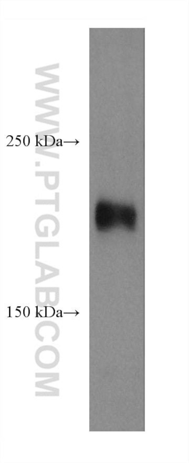 ROBO1 Antibody in Western Blot (WB)