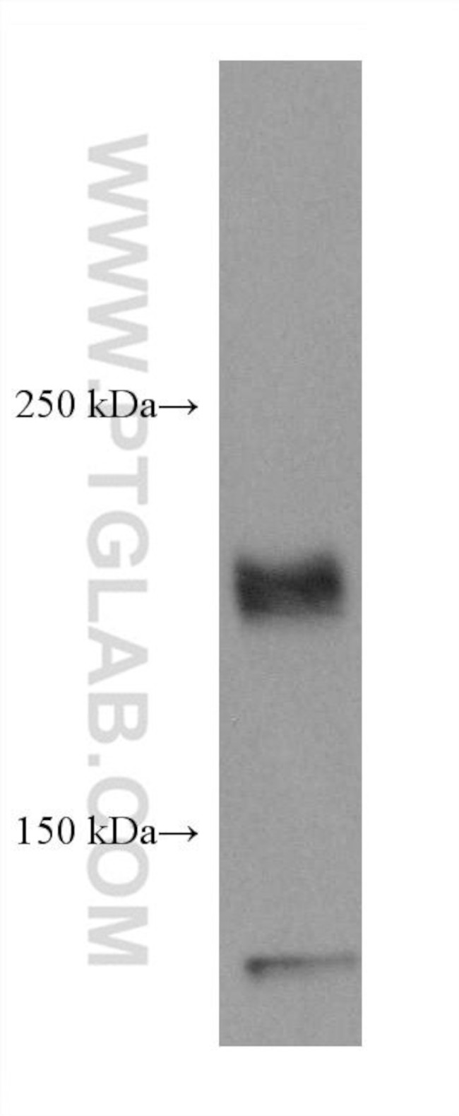 ROBO1 Antibody in Western Blot (WB)