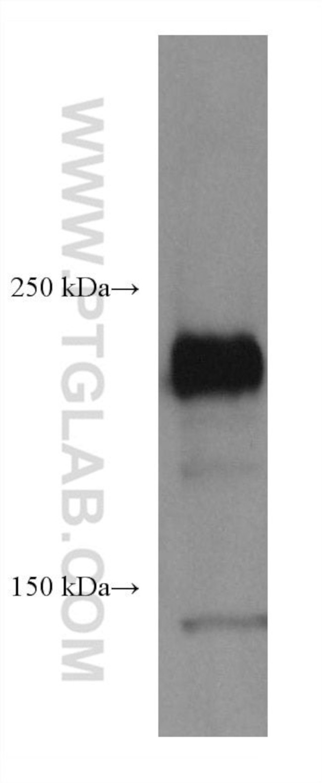 ROBO1 Antibody in Western Blot (WB)