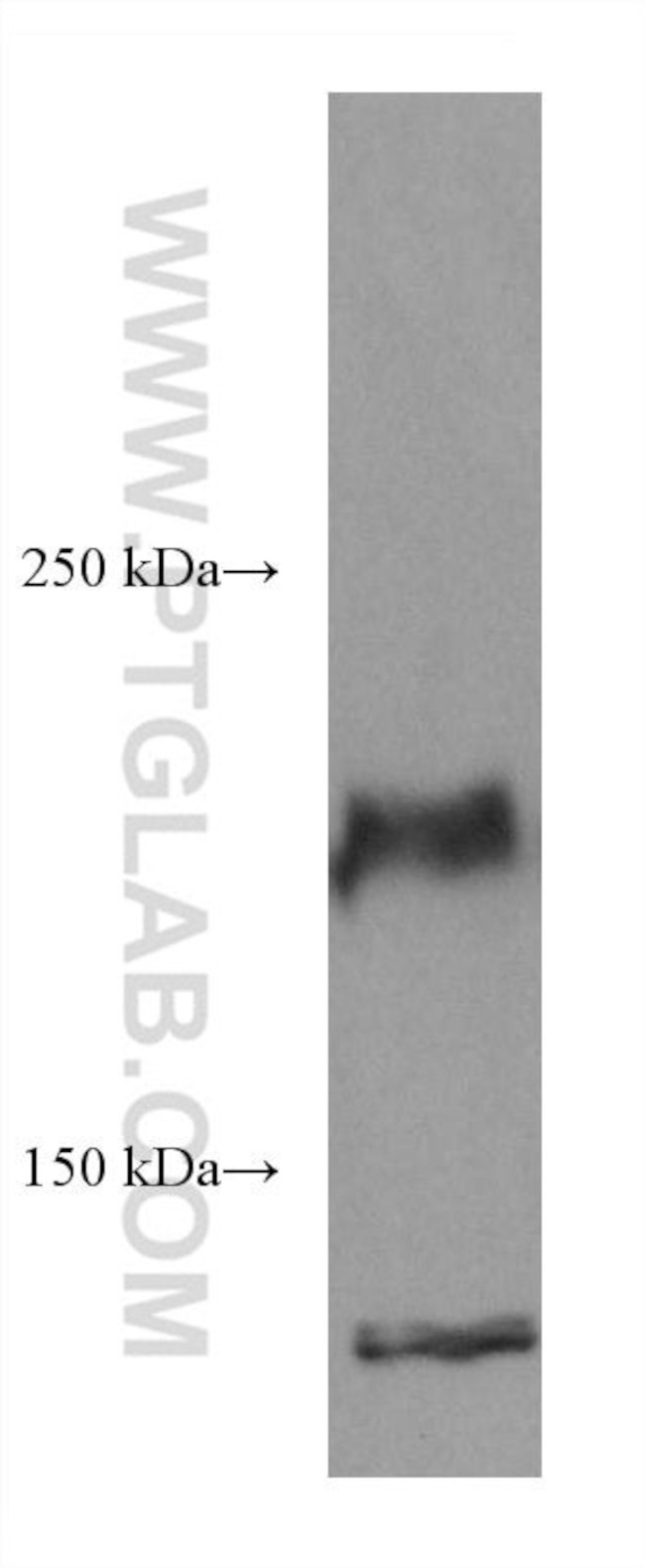 ROBO1 Antibody in Western Blot (WB)