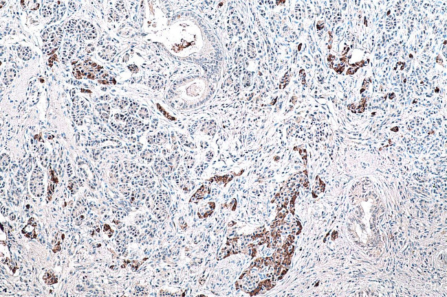 DLK1 Antibody in Immunohistochemistry (Paraffin) (IHC (P))