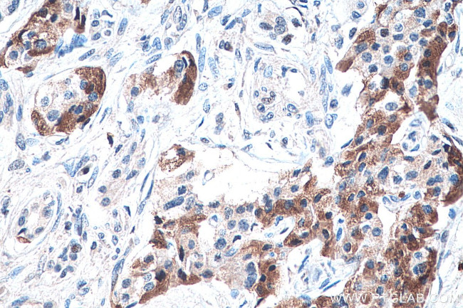 DLK1 Antibody in Immunohistochemistry (Paraffin) (IHC (P))