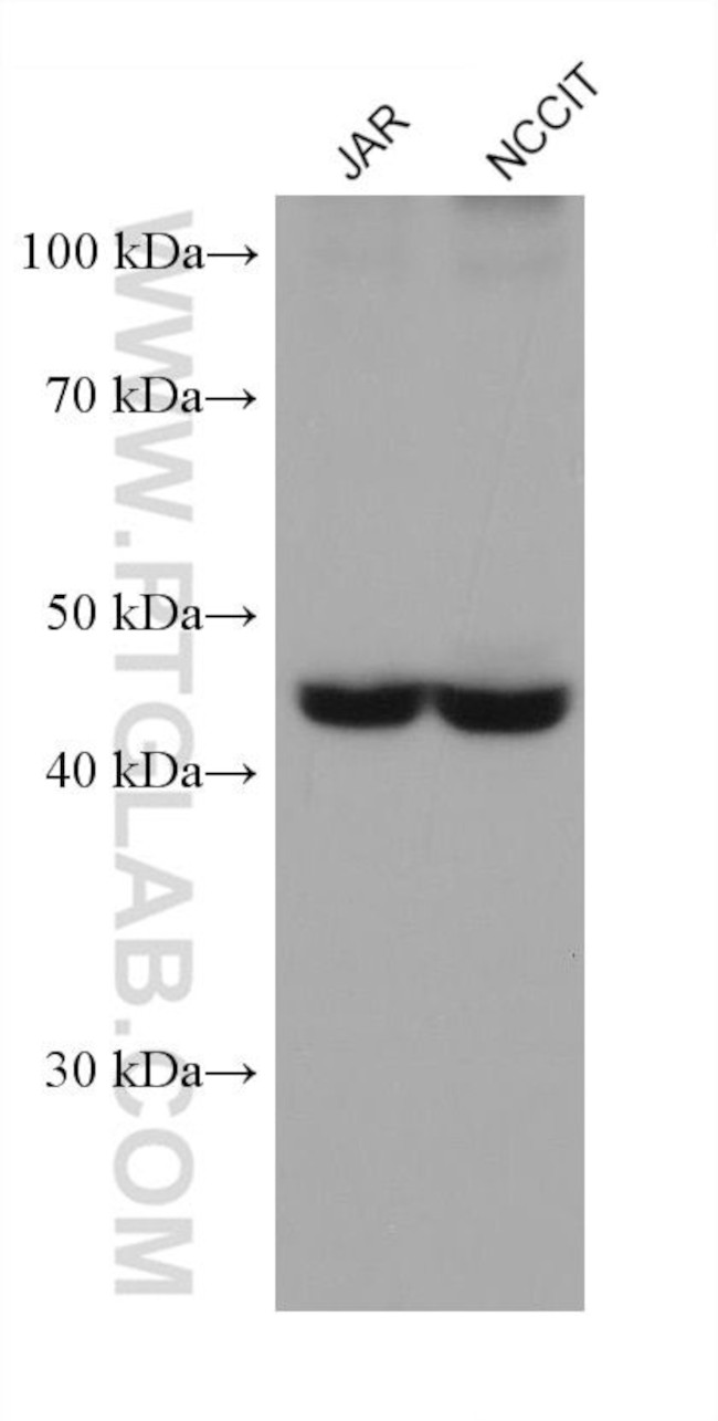 DLK1 Antibody in Western Blot (WB)