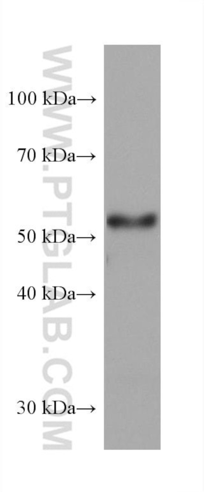 DLK1 Antibody in Western Blot (WB)