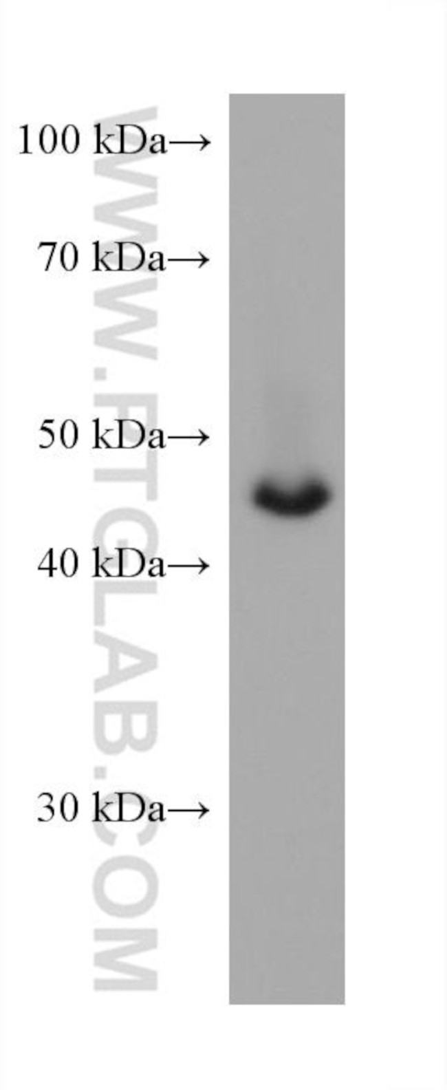 DLK1 Antibody in Western Blot (WB)