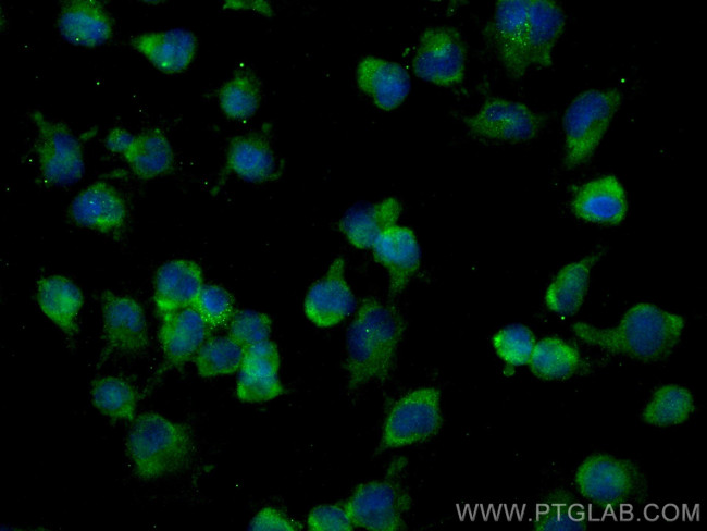 FARSB Antibody in Immunocytochemistry (ICC/IF)