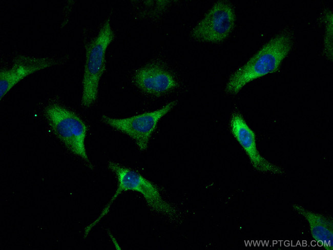 FARSB Antibody in Immunocytochemistry (ICC/IF)