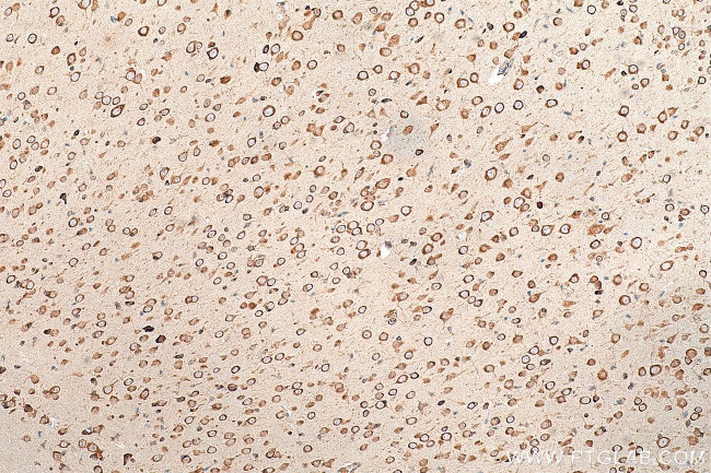 FARSB Antibody in Immunohistochemistry (Paraffin) (IHC (P))