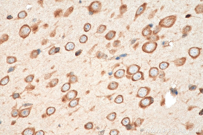 FARSB Antibody in Immunohistochemistry (Paraffin) (IHC (P))