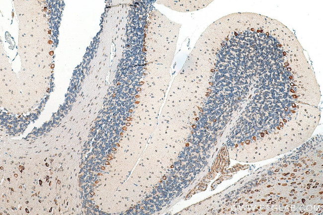 FARSB Antibody in Immunohistochemistry (Paraffin) (IHC (P))