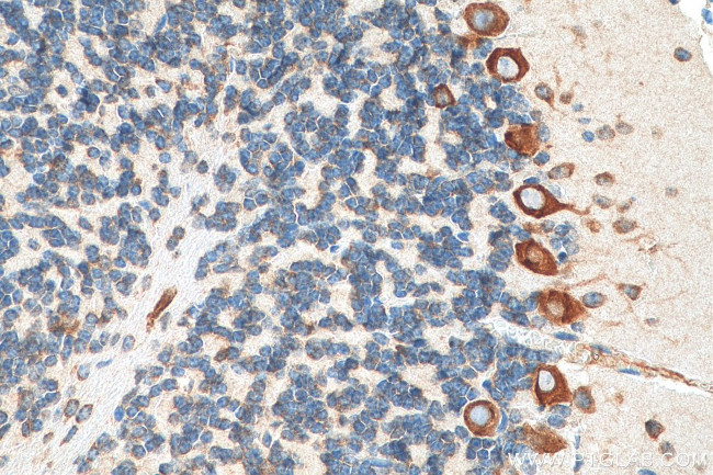 FARSB Antibody in Immunohistochemistry (Paraffin) (IHC (P))