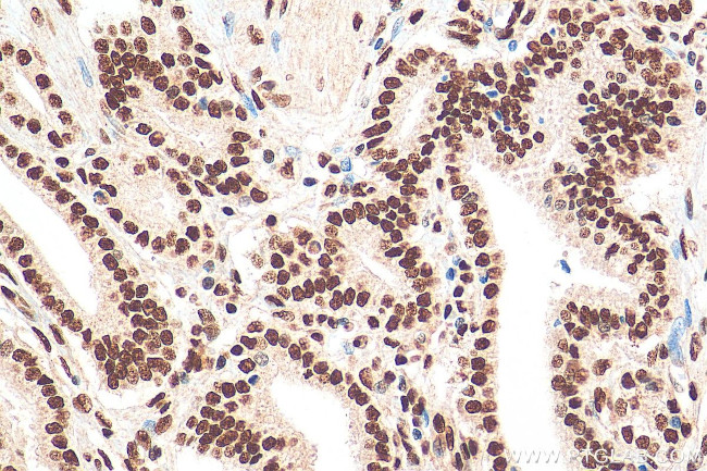 CREB1 Antibody in Immunohistochemistry (Paraffin) (IHC (P))