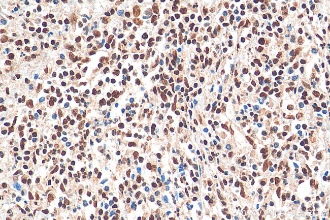 CREB1 Antibody in Immunohistochemistry (Paraffin) (IHC (P))