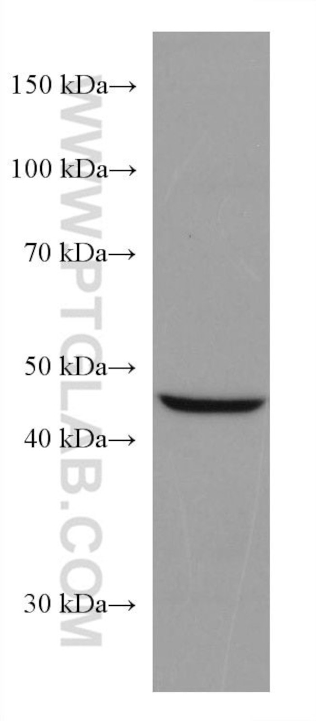 SLC36A3 Antibody in Western Blot (WB)