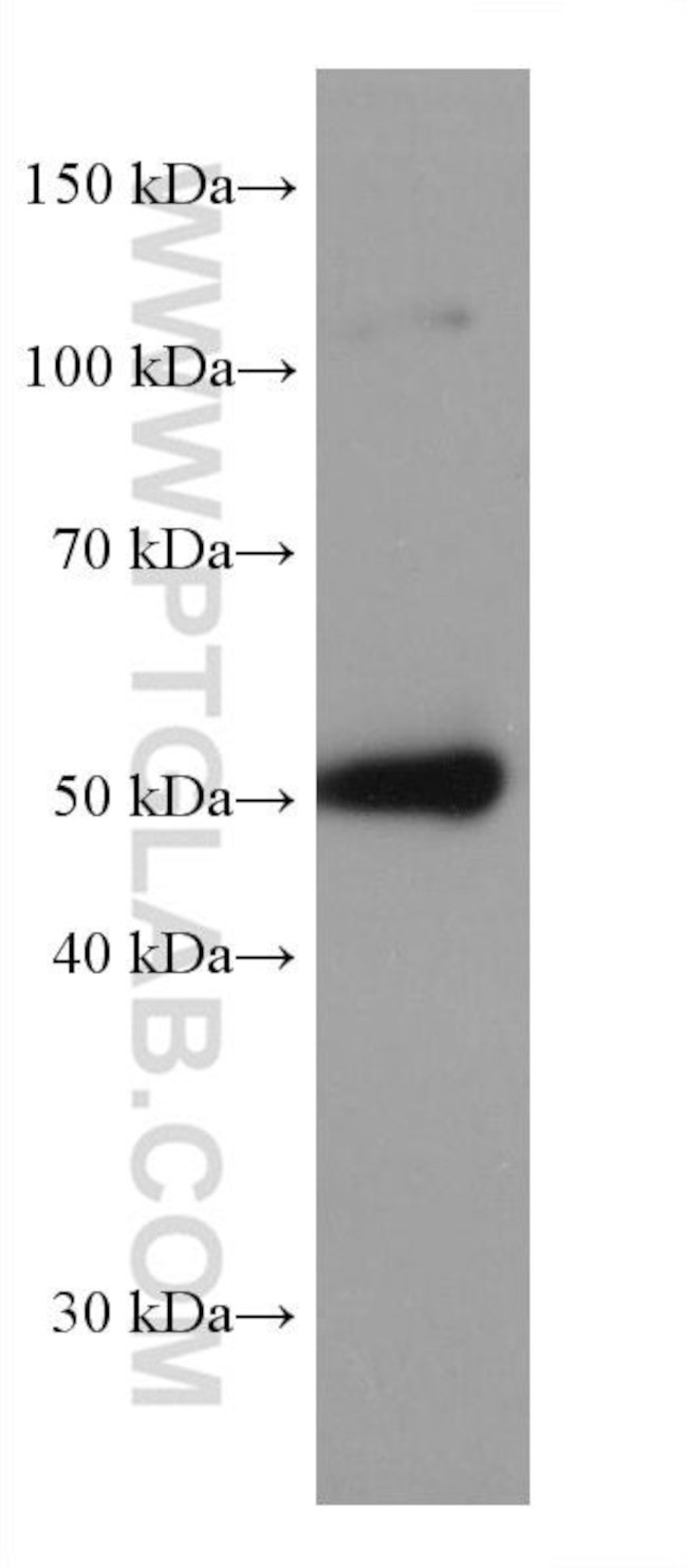 SLC36A3 Antibody in Western Blot (WB)