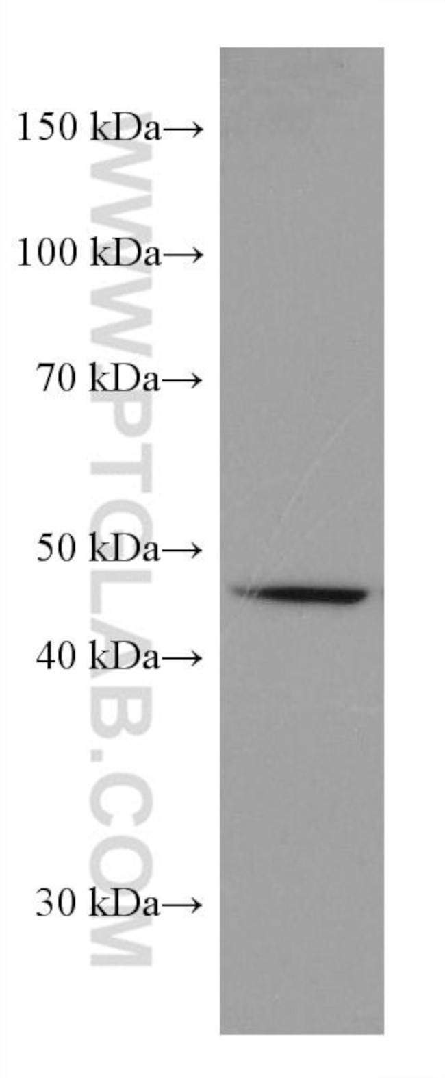 SLC36A3 Antibody in Western Blot (WB)