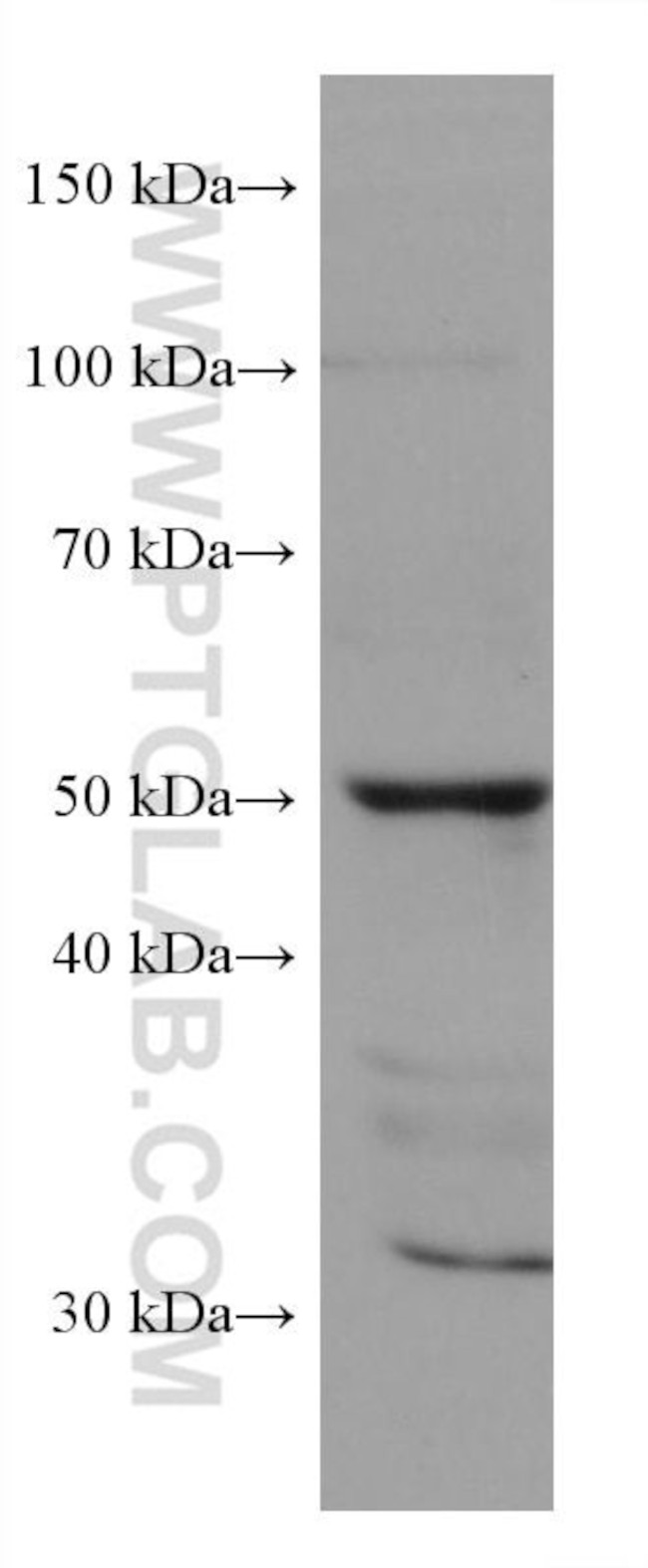 SLC36A3 Antibody in Western Blot (WB)