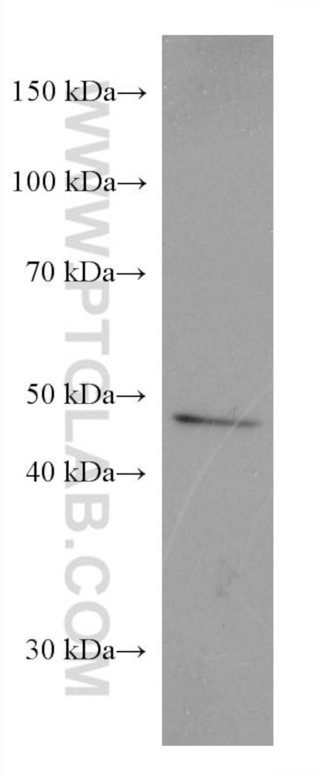 SLC36A3 Antibody in Western Blot (WB)