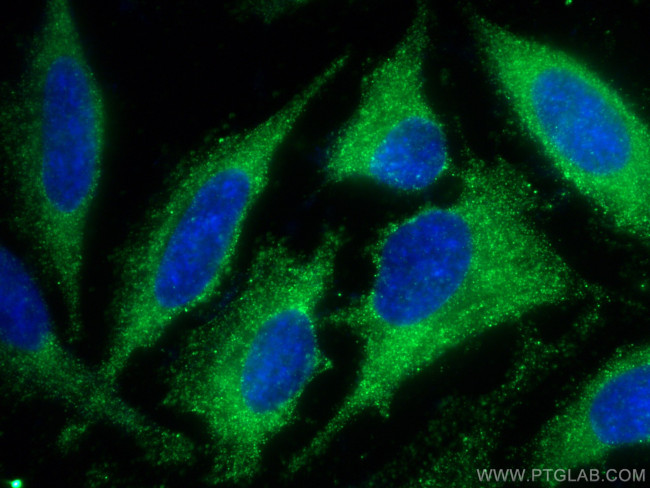 SCAMP3 Antibody in Immunocytochemistry (ICC/IF)