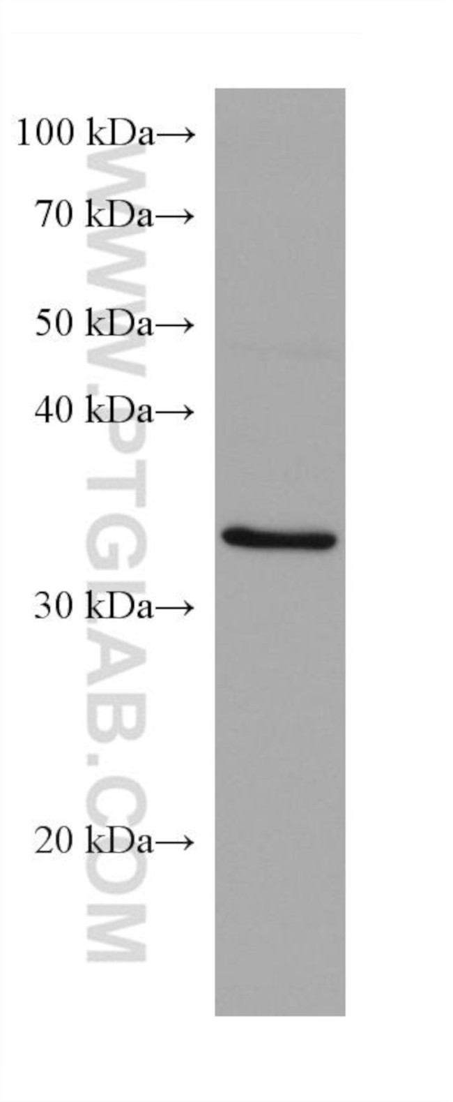 SCAMP3 Antibody in Western Blot (WB)