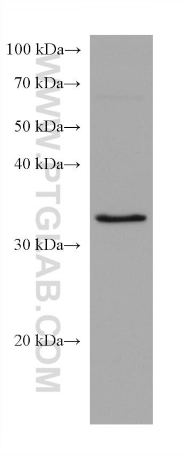 SCAMP3 Antibody in Western Blot (WB)