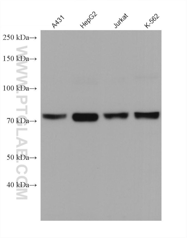 CARS Antibody in Western Blot (WB)