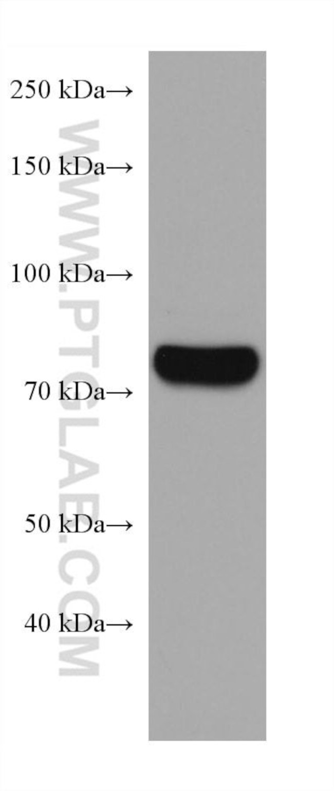 CARS Antibody in Western Blot (WB)