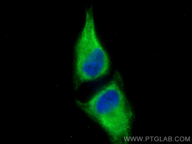 ValRS Antibody in Immunocytochemistry (ICC/IF)